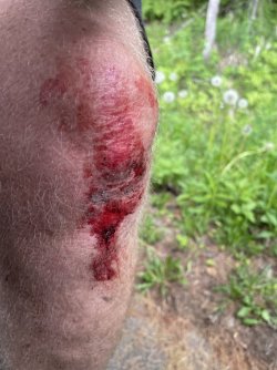 B0BBE850-3999-4F83-BEC9-AC15A36F65D2.jpeg B0BBE850-3999-4F83-BEC9-AC15A36F65D2.jpeg