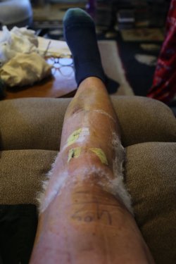 Leg_01.jpg