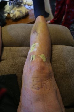 Leg_02.jpg