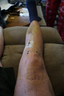 Leg_03.jpg