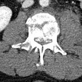 IM-0003-0038 L3.jpg IM-0003-0038 L3.jpg