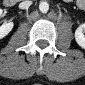 IM-0003-0031 L2.jpg IM-0003-0031 L2.jpg